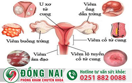 Các Loại Bệnh Âm Đạo Thường Gặp Nhất