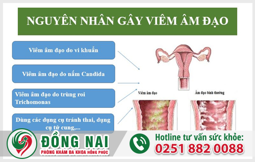 Khi âm đạo bị nhiễm khuẩn và những điều cần biết