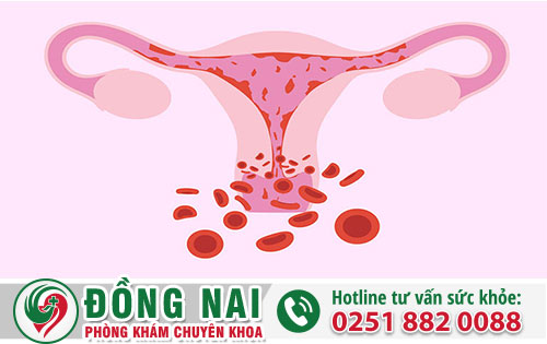 Rối Loạn Kinh Nguyệt Có Gây Nguy Hiểm Không?